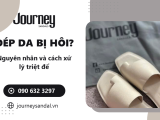 Dép Da Bị Hôi, Trơn Trượt, Đứt Quai – Nguyên Nhân Và Cách Xử Lý